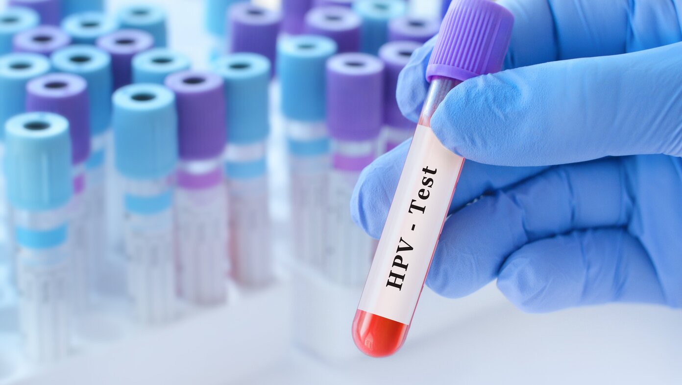 Vih/Sida: le médicament qui protège à 99,9 % bientôt fabriqué en Afrique