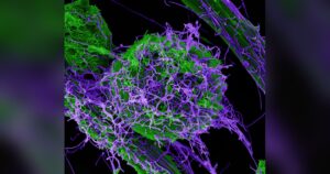 Particules du virus Ebola au microscope électronique, épidémie en RDC