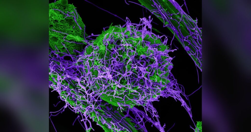 Particules du virus Ebola au microscope electronique, epidemie en RDC a 5 514 cas