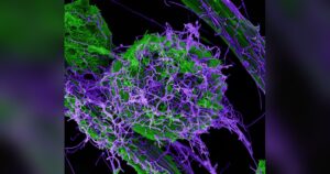Particules du virus Ebola au microscope electronique, epidemie en RDC a 5 514 cas