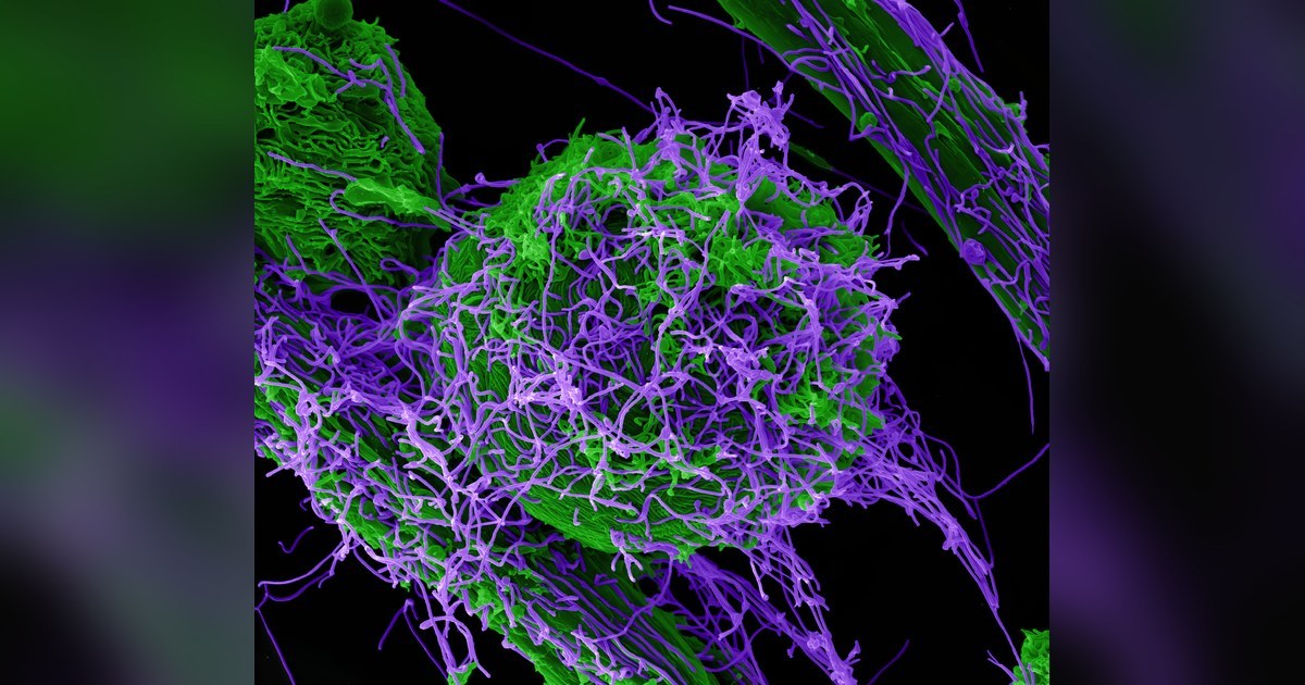 Particules du virus Ebola au microscope electronique, epidemie en RDC a 5 514 cas